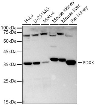 Western blot analysis of extracts of various cell lines, using PDXK antibody  at  1:640 dilution.
Secondary antibody: HRP Goat Anti-Rabbit IgG   at 1:10000 dilution.
Lysates/proteins: 25ug per lane.
Blocking buffer: 3% nonfat dry milk in TBST.
Detection: ECL Basic Kit .
Exposure time: 30s.