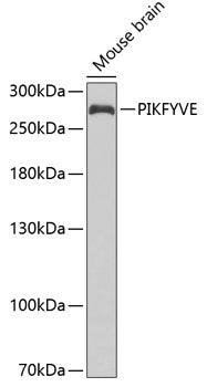 WesternBlot (WB) analysis of PIP5K3 polyclonal antibody