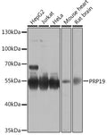 Western blot analysis of extracts of various cell lines, using PRP19 antibody  at 1:1000 dilution.
Secondary antibody: HRP Goat Anti-Rabbit IgG   at 1:10000 dilution.
Lysates/proteins: 25ug per lane.
Blocking buffer: 3% nonfat dry milk in TBST.
Detection: ECL Basic Kit .
Exposure time: 30s.
