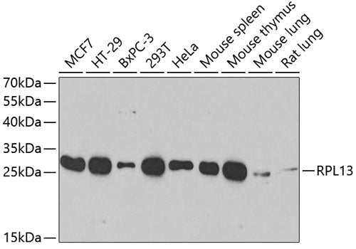 Western blot analysis of extracts of various cell lines, using RPL13 antibody  at 1:1000 dilution.
Secondary antibody: HRP Goat Anti-Rabbit IgG   at 1:10000 dilution.
Lysates/proteins: 25ug per lane.
Blocking buffer: 3% nonfat dry milk in TBST.
Detection: ECL Basic Kit .
Exposure time: 15s.