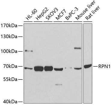 Western blot analysis of extracts of various cell lines, using RPN1 antibody  at 1:1000 dilution.
Secondary antibody: HRP Goat Anti-Rabbit IgG   at 1:10000 dilution.
Lysates/proteins: 25ug per lane.
Blocking buffer: 3% nonfat dry milk in TBST.
Detection: ECL Basic Kit .
Exposure time: 90s.