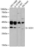 Western blot analysis of extracts of various cell lines, using SCO1 antibody  at 1:1000 dilution.
Secondary antibody: HRP Goat Anti-Rabbit IgG   at 1:10000 dilution.
Lysates/proteins: 25ug per lane.
Blocking buffer: 3% nonfat dry milk in TBST.
Detection: ECL Basic Kit .
Exposure time: 10s.