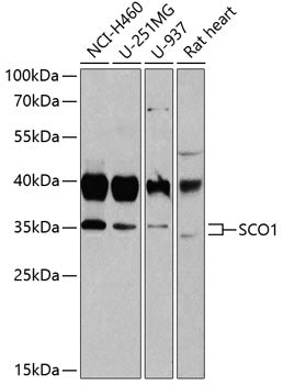 Western blot analysis of extracts of various cell lines, using SCO1 antibody  at 1:1000 dilution.
Secondary antibody: HRP Goat Anti-Rabbit IgG   at 1:10000 dilution.
Lysates/proteins: 25ug per lane.
Blocking buffer: 3% nonfat dry milk in TBST.
Detection: ECL Basic Kit .
Exposure time: 10s.