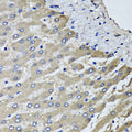 Immunohistochemistry of paraffin-embedded human liver injury using SCYL1 antibody at dilution of 1:100 (x40 lens).