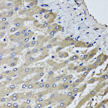 Immunohistochemistry of paraffin-embedded human liver injury using SCYL1 antibody at dilution of 1:100 (x40 lens).