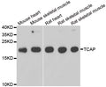 WesternBlot (WB) analysis of TCAP polyclonal antibody