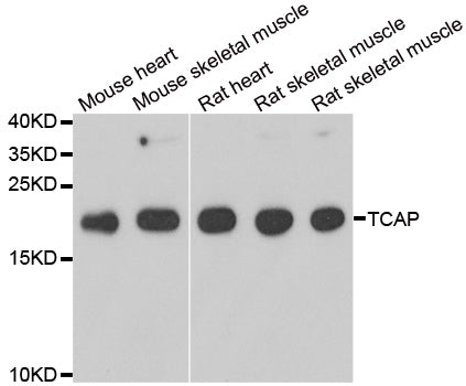 WesternBlot (WB) analysis of TCAP polyclonal antibody