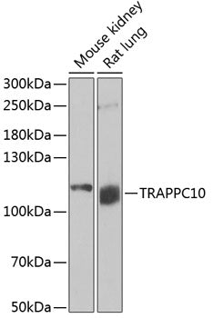 Western blot analysis of extracts of various cell lines, using TRAPPC10 antibody  at 1:1000 dilution.
Secondary antibody: HRP Goat Anti-Rabbit IgG   at 1:10000 dilution.
Lysates/proteins: 25ug per lane.
Blocking buffer: 3% nonfat dry milk in TBST.
Detection: ECL Basic Kit .
Exposure time: 15min.