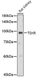 Western blot analysis of extracts of Rat kidney, using TSHR antibody  at 1:1000 dilution.
Secondary antibody: HRP Goat Anti-Rabbit IgG   at 1:10000 dilution.
Lysates/proteins: 25ug per lane.
Blocking buffer: 3% nonfat dry milk in TBST.
Detection: ECL Basic Kit .
Exposure time: 30s.