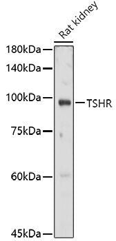 Western blot analysis of extracts of Rat kidney, using TSHR antibody  at 1:1000 dilution.
Secondary antibody: HRP Goat Anti-Rabbit IgG   at 1:10000 dilution.
Lysates/proteins: 25ug per lane.
Blocking buffer: 3% nonfat dry milk in TBST.
Detection: ECL Basic Kit .
Exposure time: 30s.