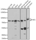 Western blot analysis of extracts of various cell lines, using NF2 antibody  at 1:1000 dilution.
Secondary antibody: HRP Goat Anti-Rabbit IgG   at 1:10000 dilution.
Lysates/proteins: 25ug per lane.
Blocking buffer: 3% nonfat dry milk in TBST.
Detection: ECL Basic Kit .
Exposure time: 60s.