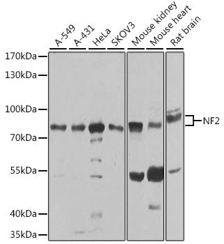 Western blot analysis of extracts of various cell lines, using NF2 antibody  at 1:1000 dilution.
Secondary antibody: HRP Goat Anti-Rabbit IgG   at 1:10000 dilution.
Lysates/proteins: 25ug per lane.
Blocking buffer: 3% nonfat dry milk in TBST.
Detection: ECL Basic Kit .
Exposure time: 60s.