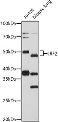 Western blot analysis of extracts of various cell lines, using   at 1:1000 dilution.
Secondary antibody: HRP Goat Anti-Rabbit IgG   at 1:10000 dilution.
Lysates/proteins: 25ug per lane.
Blocking buffer: 3% nonfat dry milk in TBST.
Detection: ECL Basic Kit .
Exposure time: 30s.