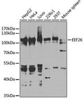 Western blot analysis of extracts of various cell lines, using EEF2K antibody  at 1:1000 dilution.
Secondary antibody: HRP Goat Anti-Rabbit IgG   at 1:10000 dilution.
Lysates/proteins: 25ug per lane.
Blocking buffer: 3% nonfat dry milk in TBST.
Detection: ECL Basic Kit .
Exposure time: 40s.