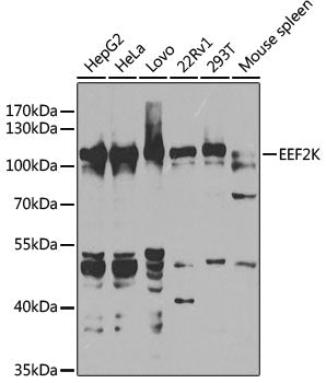 Western blot analysis of extracts of various cell lines, using EEF2K antibody  at 1:1000 dilution.
Secondary antibody: HRP Goat Anti-Rabbit IgG   at 1:10000 dilution.
Lysates/proteins: 25ug per lane.
Blocking buffer: 3% nonfat dry milk in TBST.
Detection: ECL Basic Kit .
Exposure time: 40s.