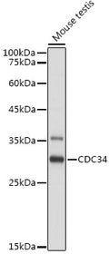Western blot analysis of extracts of Mouse testis, using CDC34 antibody  at 1:1000 dilution.
Secondary antibody: HRP Goat…