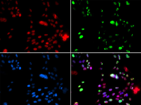 Immunofluorescence analysis of GFP-RNF168 transgenic U2OS cells using PIAS1 antibody . Green: GFP-RNF168 fusion protein expression for DNA damage marker. Blue: DAPI for nuclear staining. RNF168  can be used to mark cells damaged by UV-A laser for they always gather around DNA damage region.