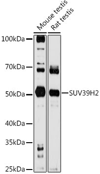 Western blot analysis of extracts of various cell lines, using SUV39H2  antibody  at 1:1000 dilution.
Secondary antibody: HRP Goat Anti-Rabbit IgG   at 1:10000 dilution.
Lysates/proteins: 25ug per lane.
Blocking buffer: 3% nonfat dry milk in TBST.
Detection: ECL Basic Kit .
Exposure time: 90s.