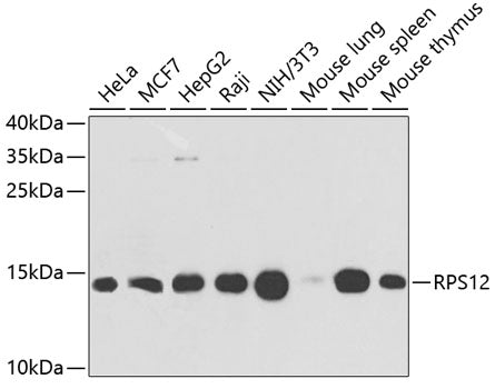Western blot analysis of extracts of various cell lines, using RPS12 antibody  at 1:1000 dilution.
Secondary antibody: HRP Goat Anti-Rabbit IgG   at 1:10000 dilution.
Lysates/proteins: 25ug per lane.
Blocking buffer: 3% nonfat dry milk in TBST.
Detection: ECL Basic Kit .
Exposure time: 15s.