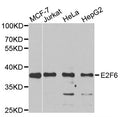 Western blot analysis of extracts of various cell lines, using E2F6 antibody.