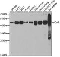 Western blot analysis of extracts of various cell lines, using OAT antibody  at 1:1000 dilution.
Secondary antibody: HRP Goat Anti-Rabbit IgG   at 1:10000 dilution.
Lysates/proteins: 25ug per lane.
Blocking buffer: 3% nonfat dry milk in TBST.
Detection: ECL Basic Kit .
Exposure time: 10s.