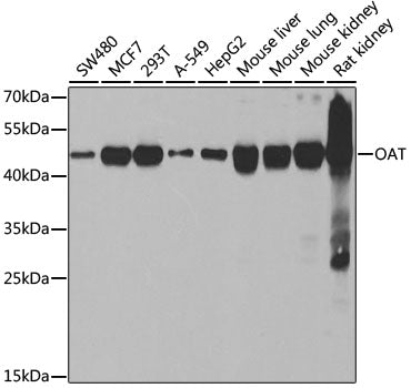 Western blot analysis of extracts of various cell lines, using OAT antibody  at 1:1000 dilution.
Secondary antibody: HRP Goat Anti-Rabbit IgG   at 1:10000 dilution.
Lysates/proteins: 25ug per lane.
Blocking buffer: 3% nonfat dry milk in TBST.
Detection: ECL Basic Kit .
Exposure time: 10s.