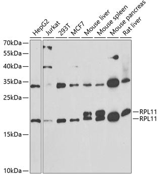Western blot analysis of extracts of various cell lines, using RPL11 antibody  at 1:1000 dilution.
Secondary antibody: HRP Goat Anti-Rabbit IgG   at 1:10000 dilution.
Lysates/proteins: 25ug per lane.
Blocking buffer: 3% nonfat dry milk in TBST.
Detection: ECL Basic Kit .
Exposure time: 90s.