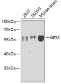 Western blot analysis of extracts of various cell lines, using GPS1 antibody  at 1:1000 dilution.
Secondary antibody: HRP Goat Anti-Rabbit IgG   at 1:10000 dilution.
Lysates/proteins: 25ug per lane.
Blocking buffer: 3% nonfat dry milk in TBST.
Detection: ECL Enhanced Kit .
Exposure time: 90s.