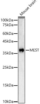 Western blot analysis of Mouse brain, using MEST antibody  at 1:2812 dilution.
Secondary antibody: HRP Goat Anti-Rabbit IgG   at 1:10000 dilution.
Lysates/proteins: 25ug per lane.
Blocking buffer: 3% nonfat dry milk in TBST.
Detection: ECL Basic Kit .
Exposure time: 60s.