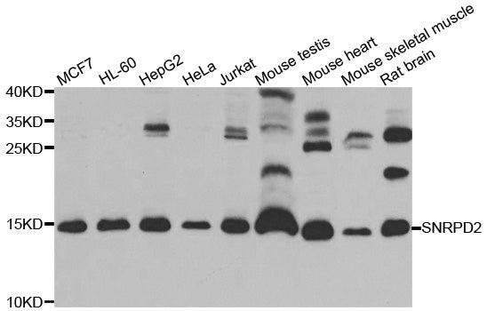 Western blot analysis of extracts of various cell lines, using SNRPD2 antibody.