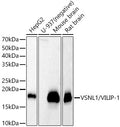 Western blot analysis of various lysates, using VSNL1/VILIP-1 antibody  at  1:430 dilution.
Secondary antibody: HRP Goat Anti-Rabbit IgG   at 1:10000 dilution.
Lysates/proteins: 25ug per lane.
Blocking buffer: 3% nonfat dry milk in TBST.
Detection: ECL Basic Kit .
Exposure time: 30s.