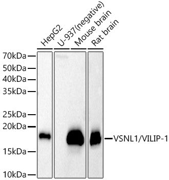 Western blot analysis of various lysates, using VSNL1/VILIP-1 antibody  at  1:430 dilution.
Secondary antibody: HRP Goat Anti-Rabbit IgG   at 1:10000 dilution.
Lysates/proteins: 25ug per lane.
Blocking buffer: 3% nonfat dry milk in TBST.
Detection: ECL Basic Kit .
Exposure time: 30s.