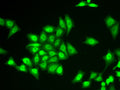 ZNF217 polyclonal antibody – Figure 1 of 1