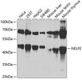 Western blot analysis of extracts of various cell lines, using NELFE antibody  at 1:1000 dilution.
Secondary antibody: HRP…
