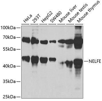 Western blot analysis of extracts of various cell lines, using NELFE antibody  at 1:1000 dilution.
Secondary antibody: HRP…