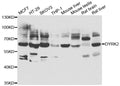 Western blot analysis of extracts of various cell lines, using DYRK2 antibody.