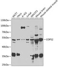 Western blot analysis of extracts of various cell lines, using COPS2 antibody  at 1:1000 dilution.
Secondary antibody: HRP Goat Anti-Rabbit IgG   at 1:10000 dilution.
Lysates/proteins: 25ug per lane.
Blocking buffer: 3% nonfat dry milk in TBST.
Detection: ECL Basic Kit .
Exposure time: 90s.