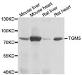 Western blot analysis of extracts of various cell lines, using TGM5 antibody.