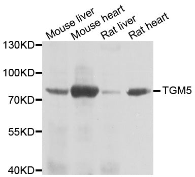 Western blot analysis of extracts of various cell lines, using TGM5 antibody.