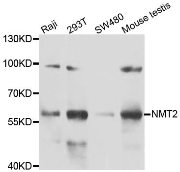 Western blot analysis of extracts of various cell lines, using NMT2 antibody.