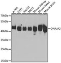 Western blot analysis of extracts of various cell lines, using DNAJA2 antibody  at 1:3000 dilution.
Secondary antibody: HRP Goat Anti-Rabbit IgG   at 1:10000 dilution.
Lysates/proteins: 25ug per lane.
Blocking buffer: 3% nonfat dry milk in TBST.
Detection: ECL Basic Kit .
Exposure time: 5s.