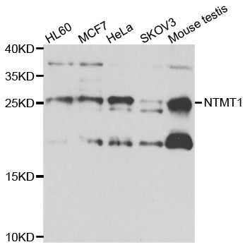 Western blot analysis of extracts of various cell lines, using NTMT1 antibody.