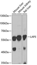 Western blot analysis of extracts of various cell lines, using LAP3 antibody  at 1:1000 dilution.
Secondary antibody: HRP Goat Anti-Rabbit IgG   at 1:10000 dilution.
Lysates/proteins: 25ug per lane.
Blocking buffer: 3% nonfat dry milk in TBST.
Detection: ECL Basic Kit .
Exposure time: 30s.