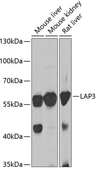 Western blot analysis of extracts of various cell lines, using LAP3 antibody  at 1:1000 dilution.
Secondary antibody: HRP Goat Anti-Rabbit IgG   at 1:10000 dilution.
Lysates/proteins: 25ug per lane.
Blocking buffer: 3% nonfat dry milk in TBST.
Detection: ECL Basic Kit .
Exposure time: 30s.