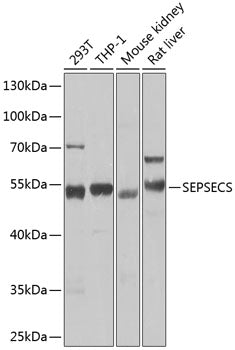 Western blot analysis of extracts of various cell lines, using SEPSECS Antibody  at 1:1000 dilution.
Secondary antibody: HRP Goat Anti-Rabbit IgG   at 1:10000 dilution.
Lysates/proteins: 25ug per lane.
Blocking buffer: 3% nonfat dry milk in TBST.
Detection: ECL Basic Kit .
Exposure time: 3s.