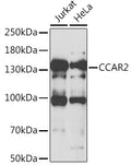 Western blot analysis of extracts of various cell lines, using CCAR2 antibody  at 1:1000 dilution.
Secondary antibody: HRP Goat Anti-Rabbit IgG   at 1:10000 dilution.
Lysates/proteins: 25ug per lane.
Blocking buffer: 3% nonfat dry milk in TBST.
Detection: ECL Basic Kit .
Exposure time: 30s.