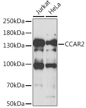 Western blot analysis of extracts of various cell lines, using CCAR2 antibody  at 1:1000 dilution.
Secondary antibody: HRP Goat Anti-Rabbit IgG   at 1:10000 dilution.
Lysates/proteins: 25ug per lane.
Blocking buffer: 3% nonfat dry milk in TBST.
Detection: ECL Basic Kit .
Exposure time: 30s.