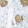 Immunohistochemistry of paraffin-embedded rat kidney using CSRNP1 antibody  at dilution of 1:200 .Perform microwave antigen…