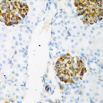 Immunohistochemistry of paraffin-embedded rat kidney using CSRNP1 antibody  at dilution of 1:200 .Perform microwave antigen…