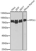Western blot analysis of extracts of various cell lines, using FIP1L1 antibody  at 1:1000 dilution.
Secondary antibody: HRP Goat Anti-Rabbit IgG   at 1:10000 dilution.
Lysates/proteins: 25ug per lane.
Blocking buffer: 3% nonfat dry milk in TBST.
Detection: ECL Basic Kit .
Exposure time: 90s.